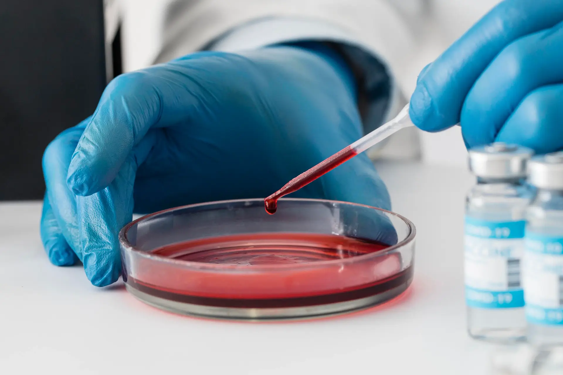 Selecting the Right Blood Plasma Separator