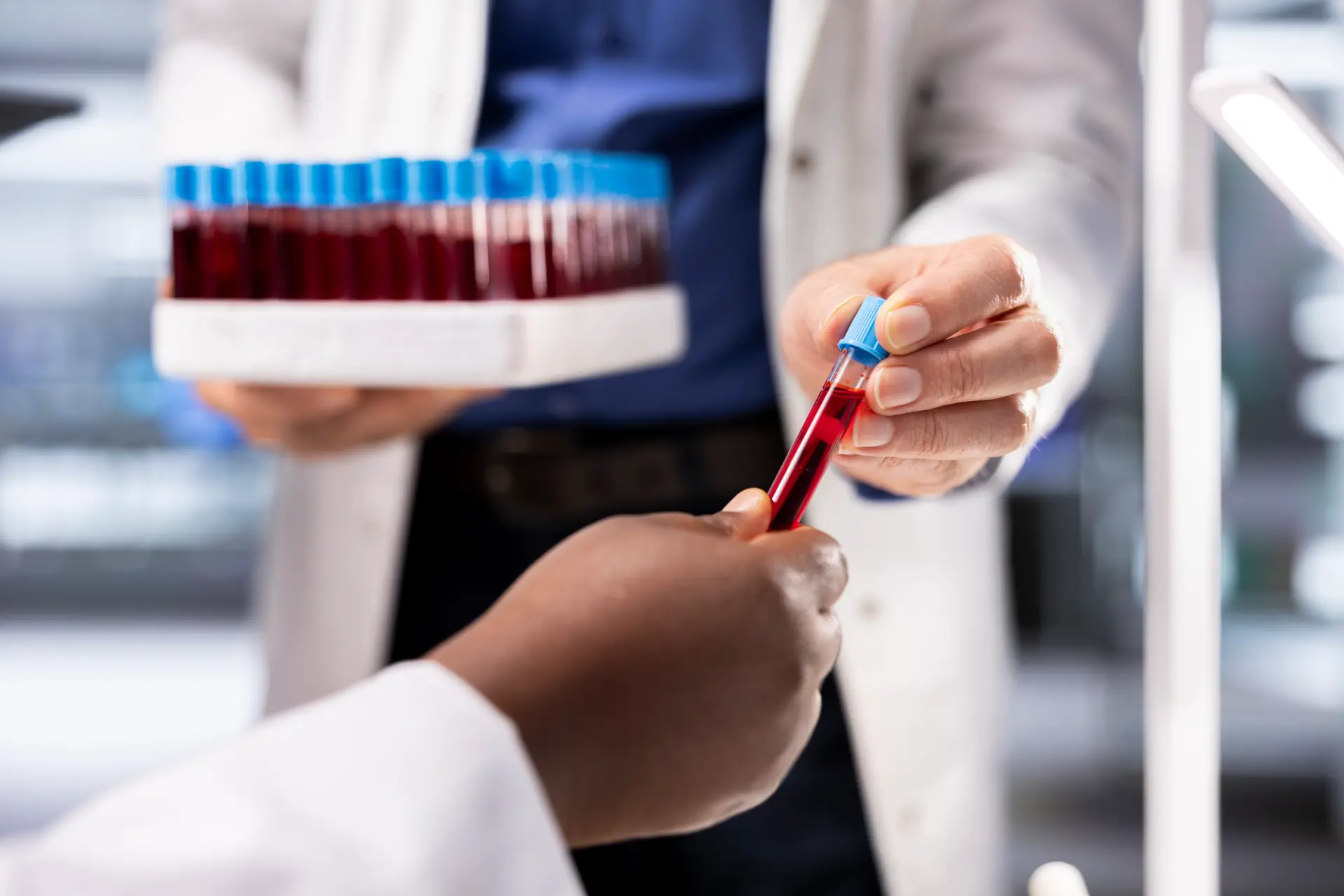Scaling Blood Testing Operations with High-Capacity Plasma Separators, illustration 1