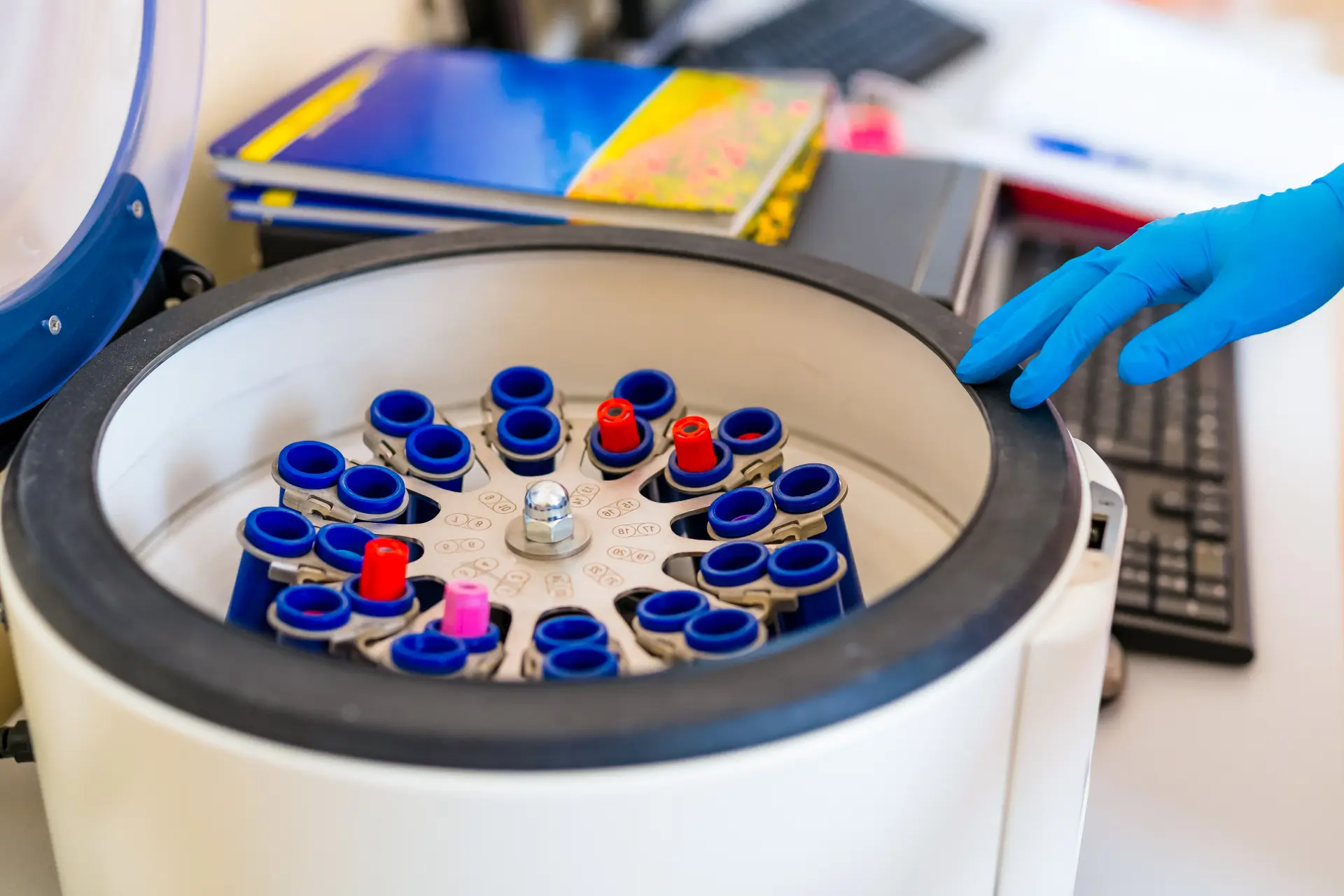 The Main Types of Used Centrifuges on the Market, illustration 2