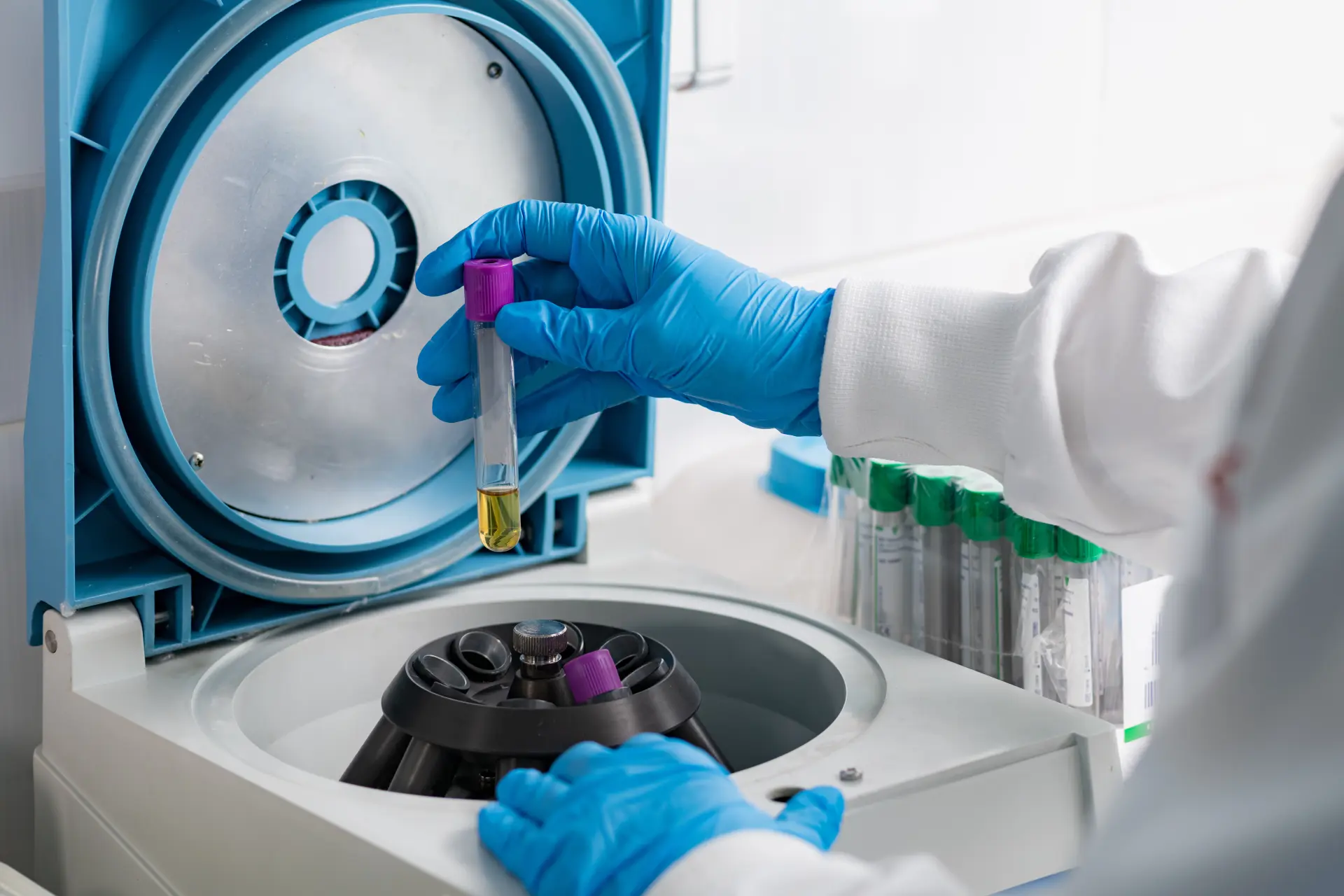What to Inspect Before Buying a Used Centrifuge